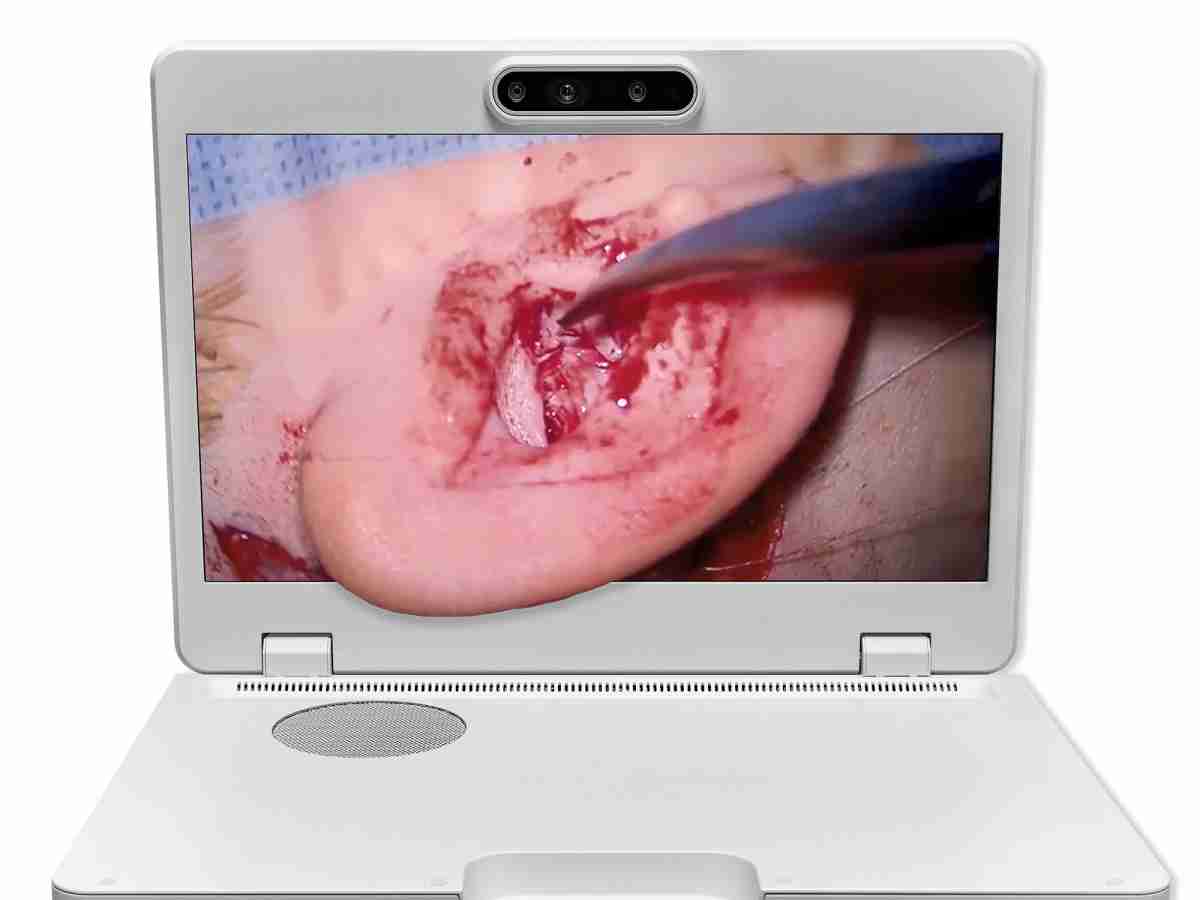 达擎之＂Heads-up 3D显微手术显示系统＂，，整合4K裸眼3D显示及眼球追踪系统，，具备快速追踪人眼移动位置功能，，减轻医师长时间维持固定姿势的负担，，，让医师能有更宽广清晰的3D立体视野及更舒适的姿势来执行手术。。。